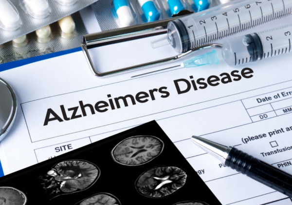 Alzheimer’s conference at ASU to highlight advances in fight against disease | ASU News