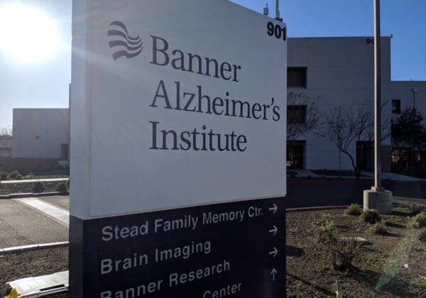 Recruiting people to participate in Alzheimer’s studies is tough. Now, experts have solutions | KJZZ
